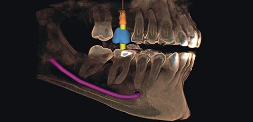 Leticia Diego López-3
