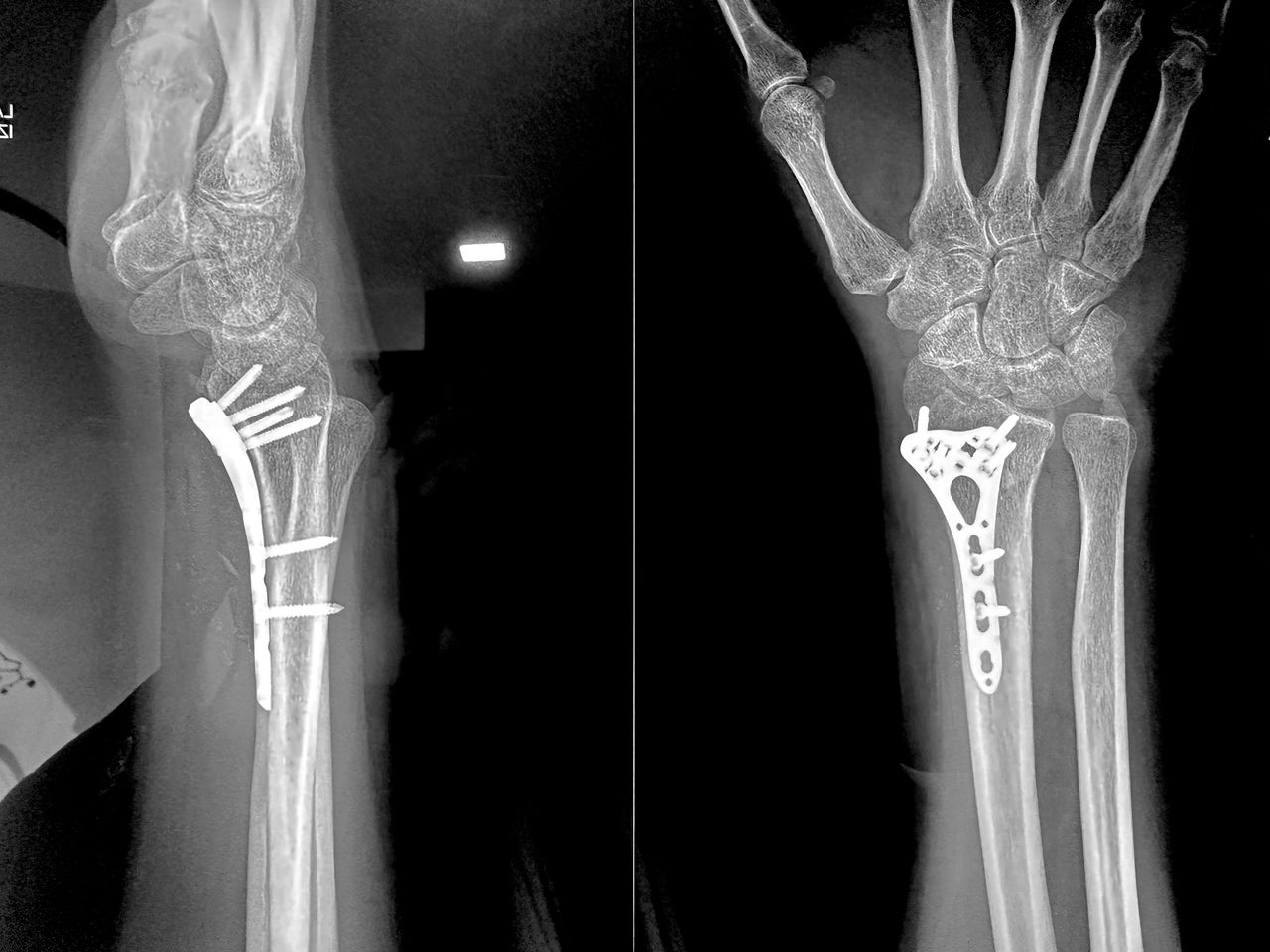 Carlos Ignacio Muñoz Valadez-43