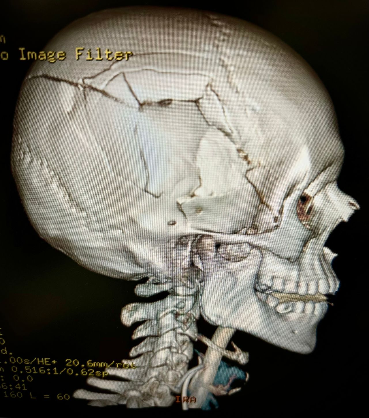 Isaac E. Tello Mata-15