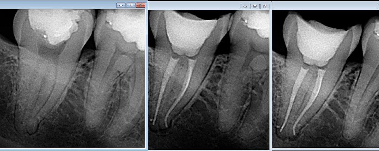 Lesli Erendira Campechano Zaragoza-17