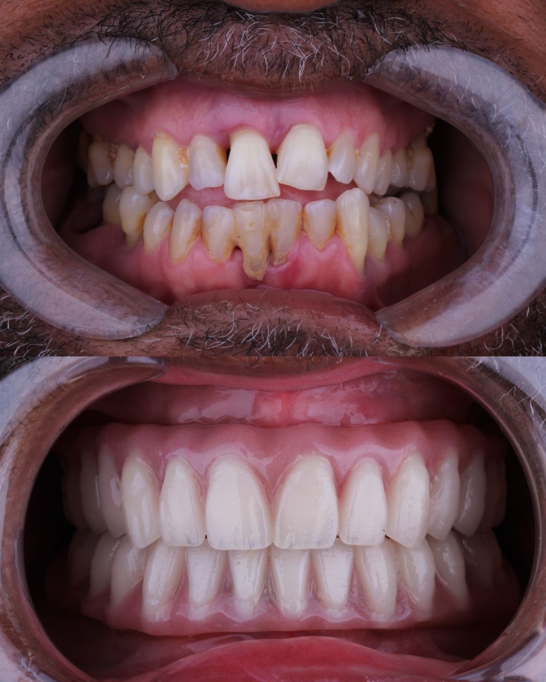 Arturo Mendez Valencia-25