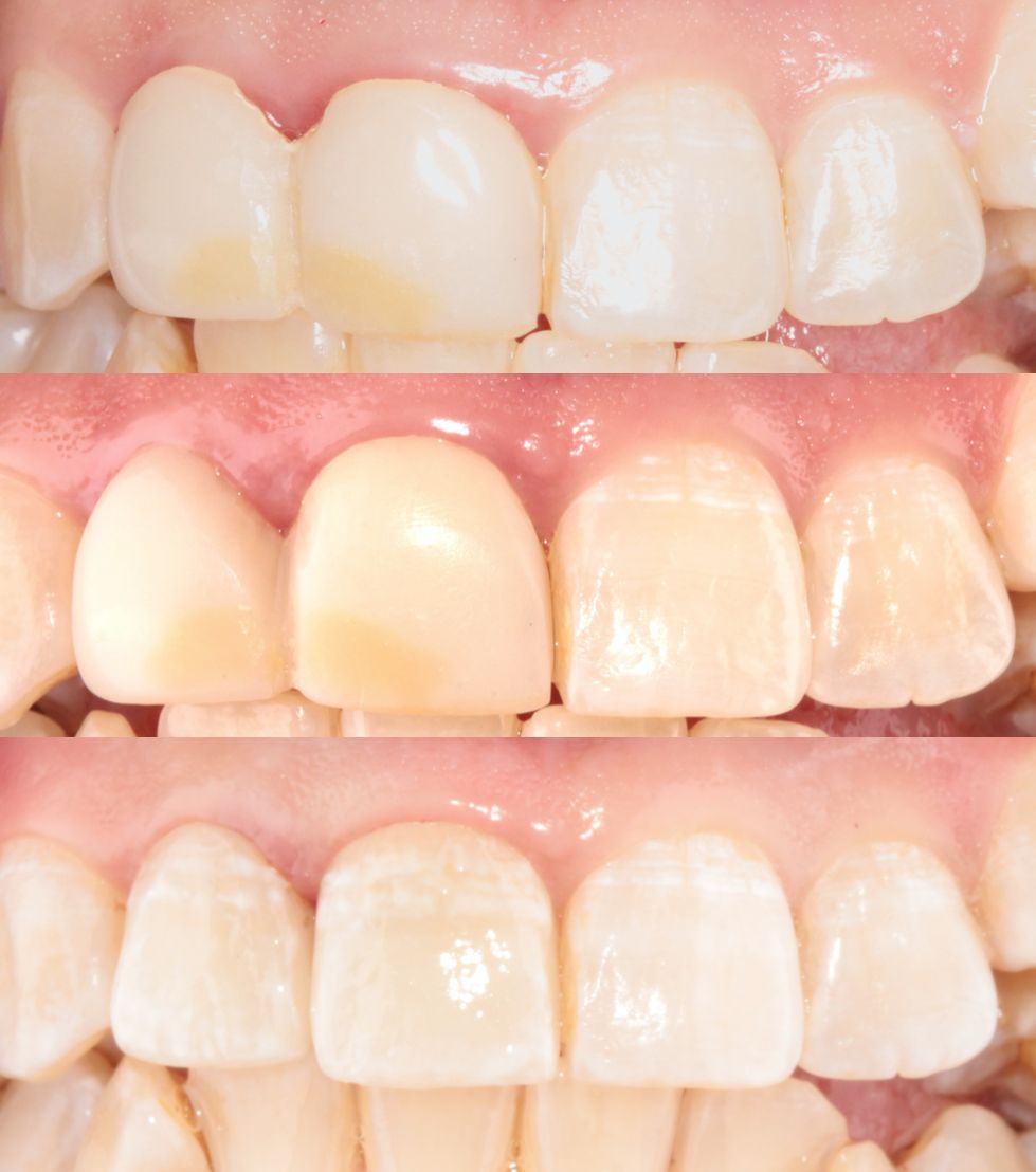 Aide Montserrat Orozco Gutierrez-30