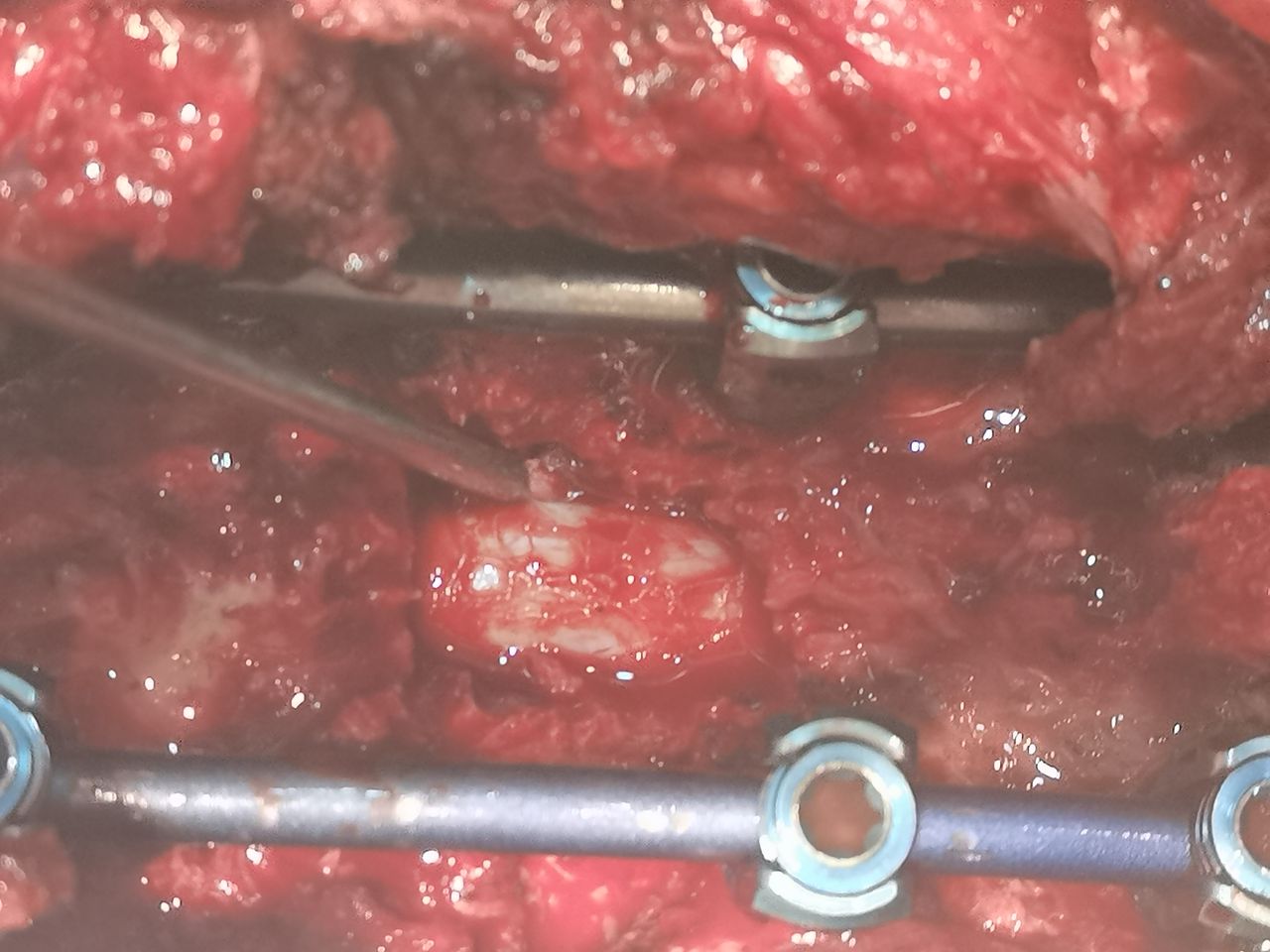 Flavio Aaron Bernal Kautzman-0