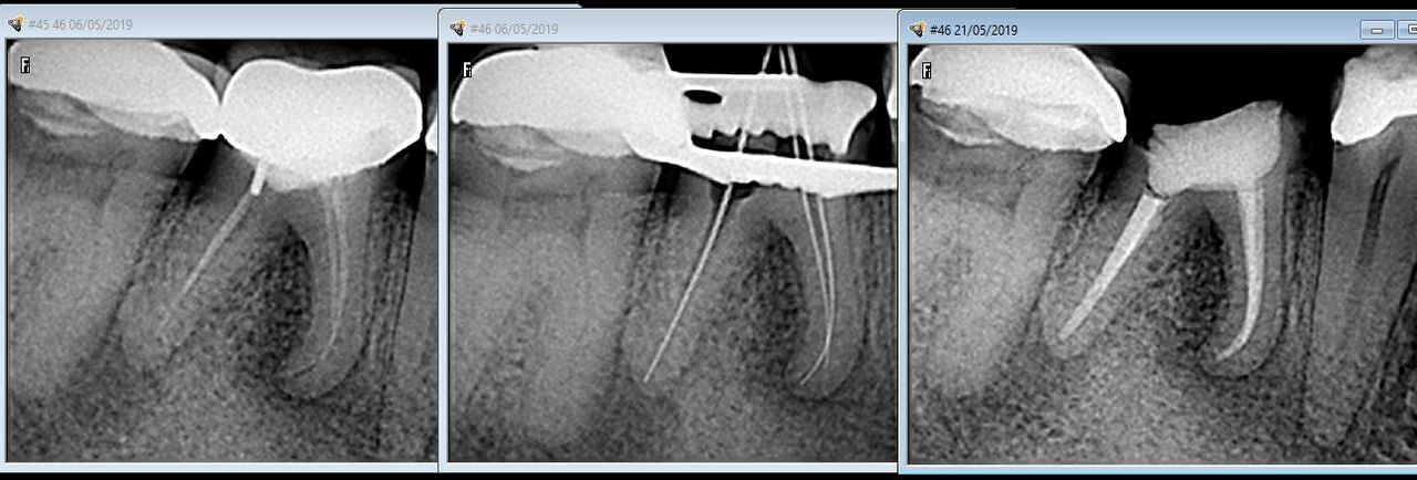 Lesli Erendira Campechano Zaragoza-15
