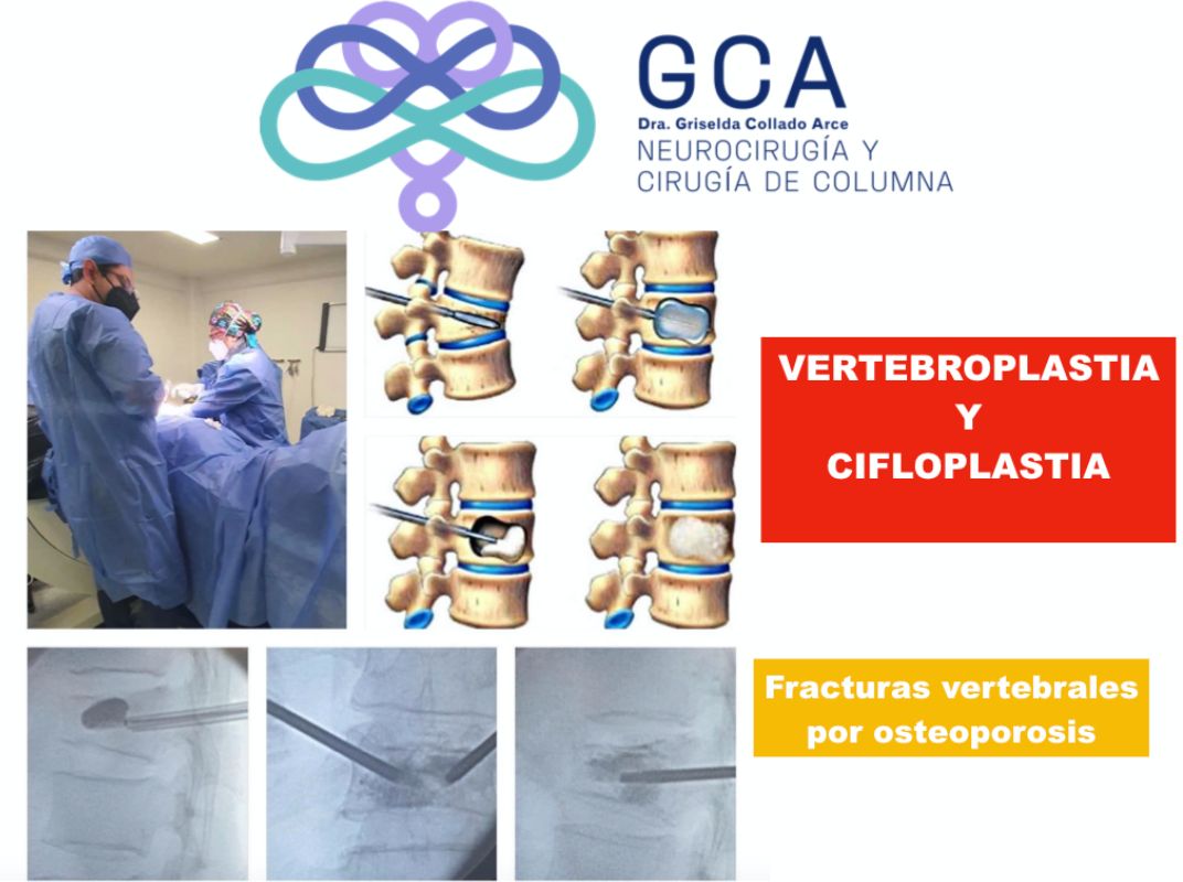 Griselda Collado Arce-1