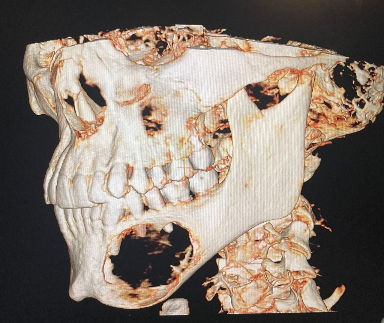 Sergio Fernando García Aguilar-2