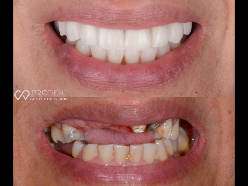 Ramiro Ivan Pérez Murillo-17