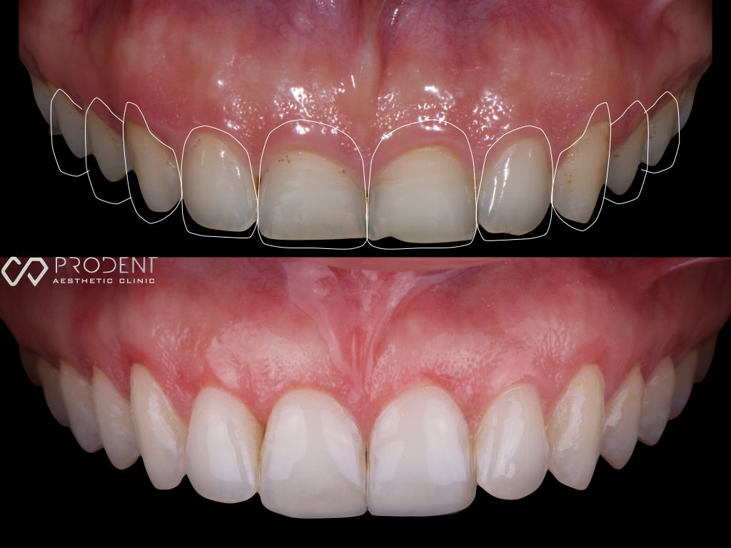 Ulises Pérez Murillo-73