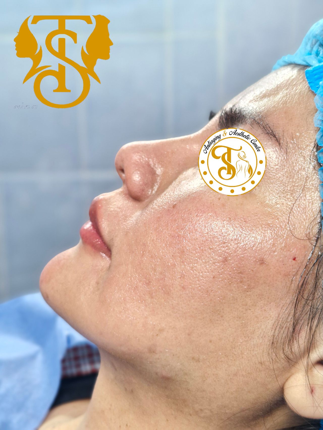 Samuel Torres Torres-16