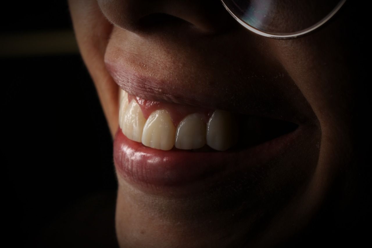 Oscar Alejandro Azcárate Tendilla-18