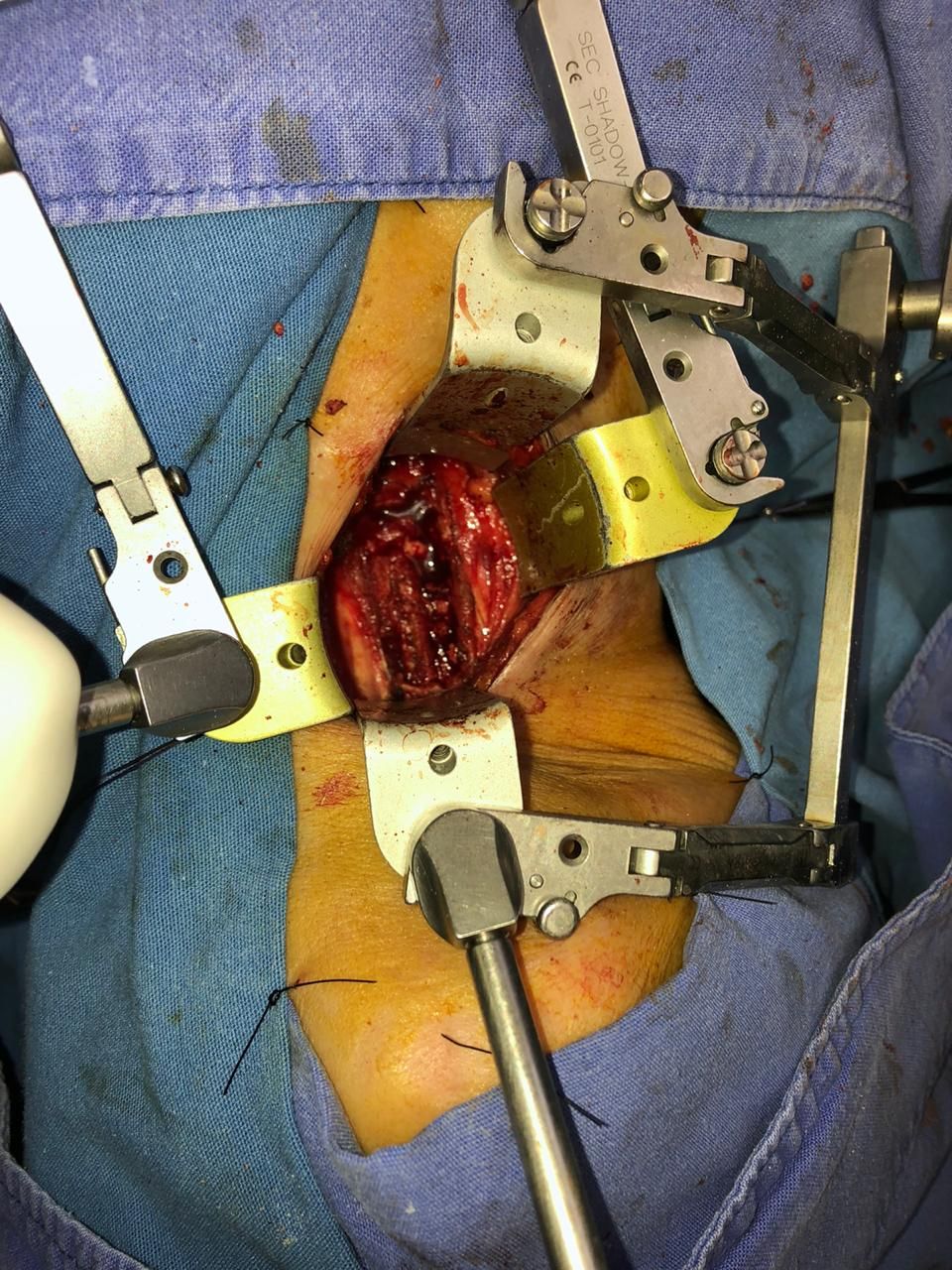 Juan José Luévano De La Cruz-15