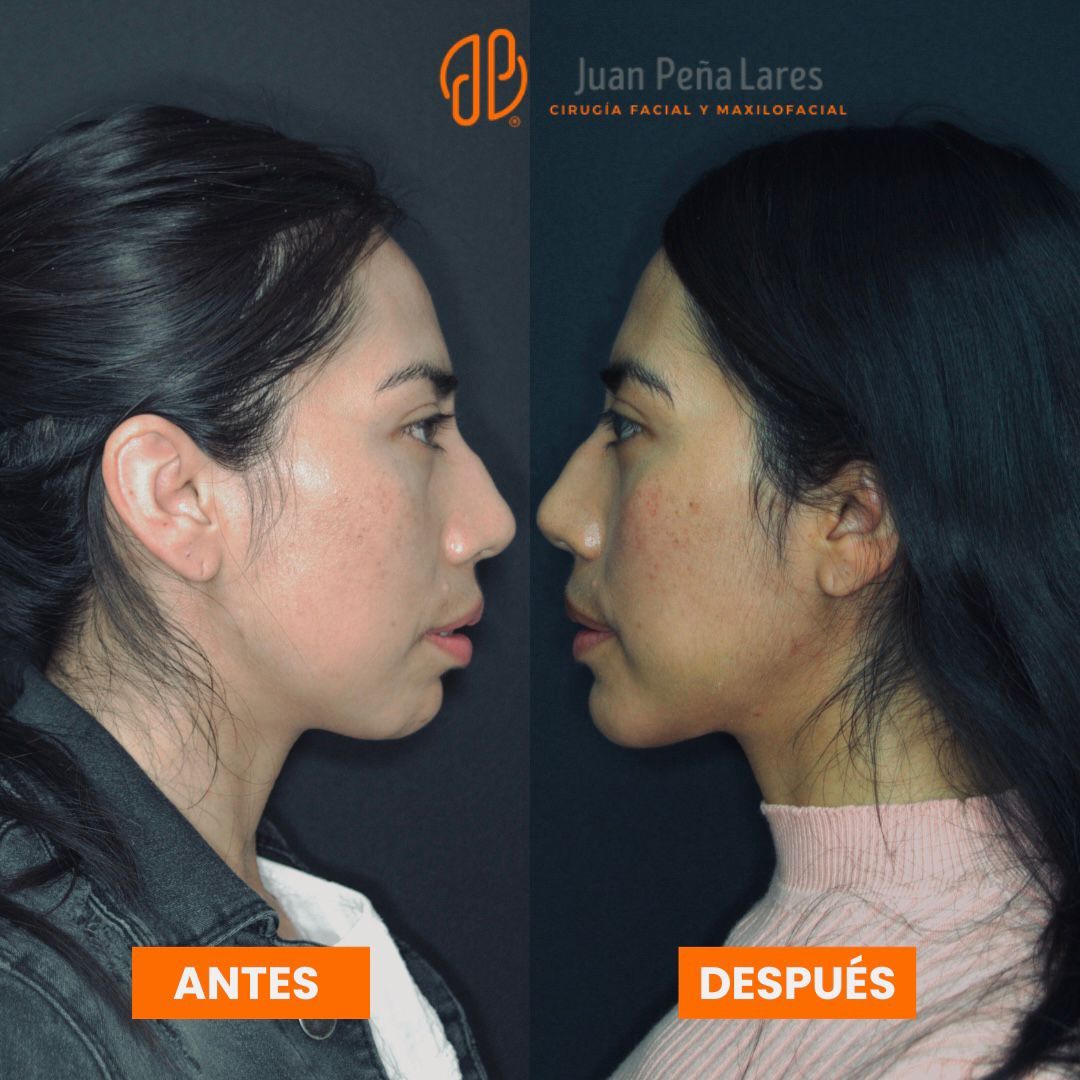 Juan Peña Lares-6