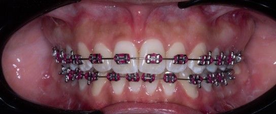 Vicente Emmanuel Silva Rangel-12