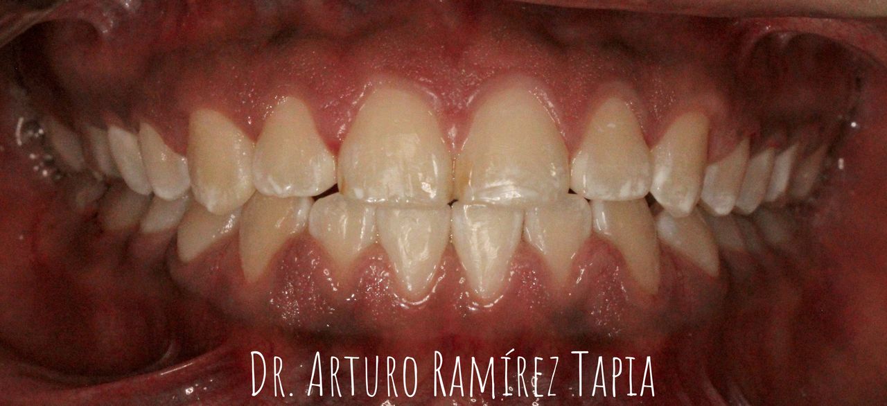 Arturo Ramírez Tapia-10