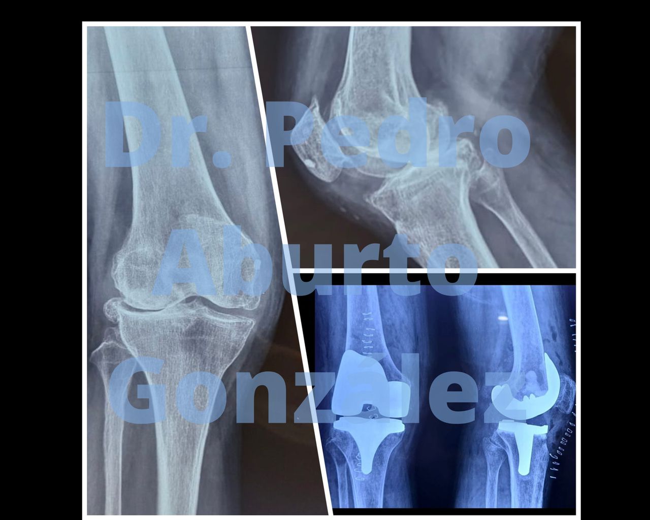 Pedro Aburto González-0