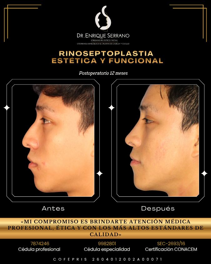 Enrique Serrano Cruz-0