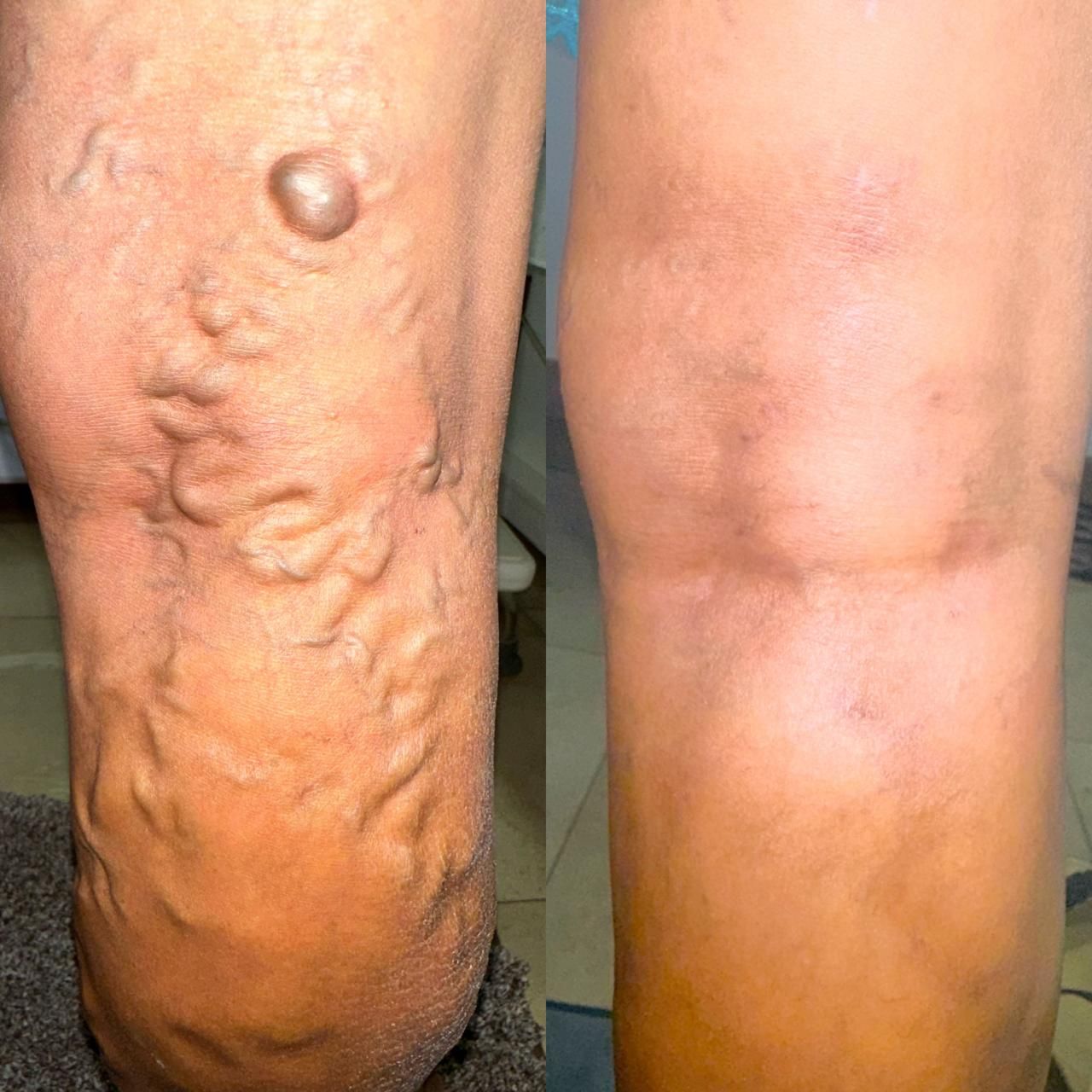 Jhonatan López González-3