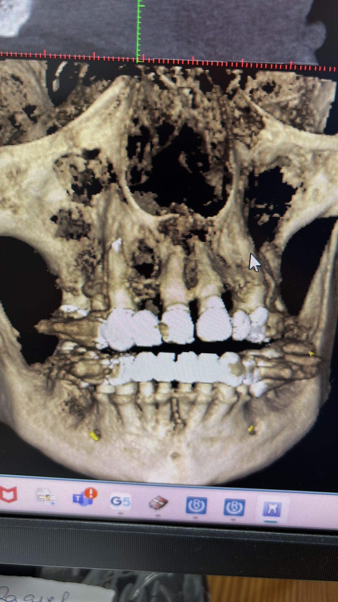 Juan Angel Cruz Rodríguez-10
