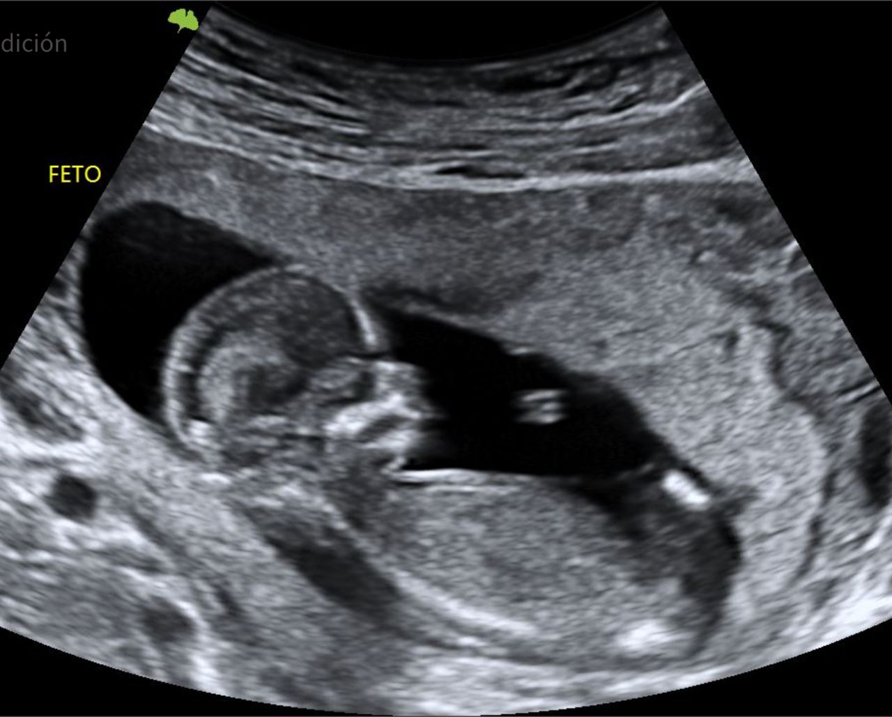 Carlos Ulises Romero Zarate-6