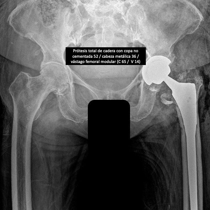 J. Miguel Zamarripa Jáuregui-16