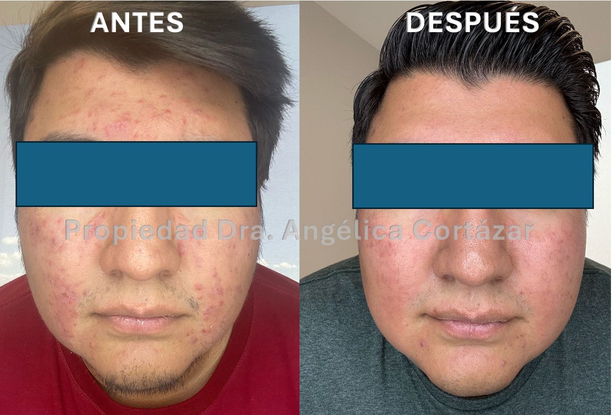 Angélica María Cortázar Azuaje-12