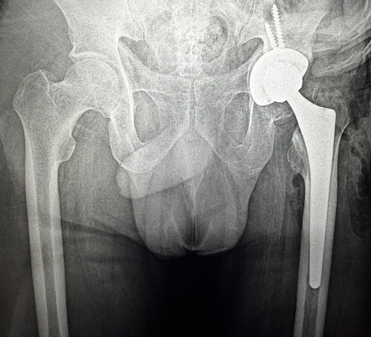 Alejandro Martínez Ramírez-33