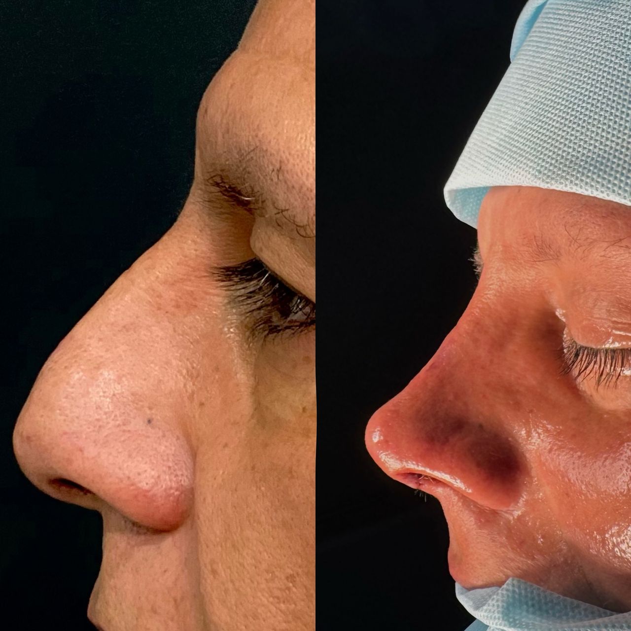 Giuseppe Tanzillo-69