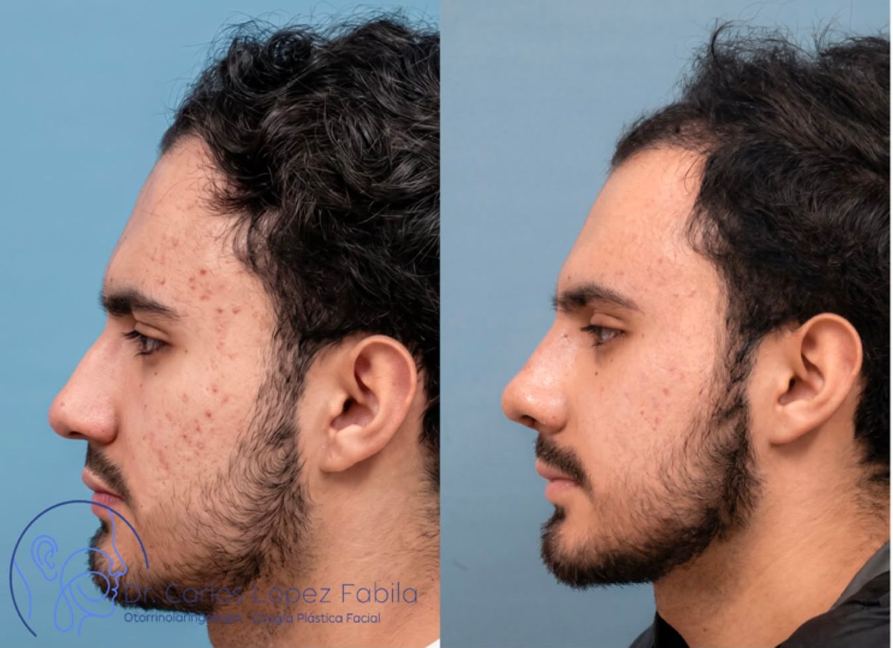 Carlos Andrés López Fabila-7
