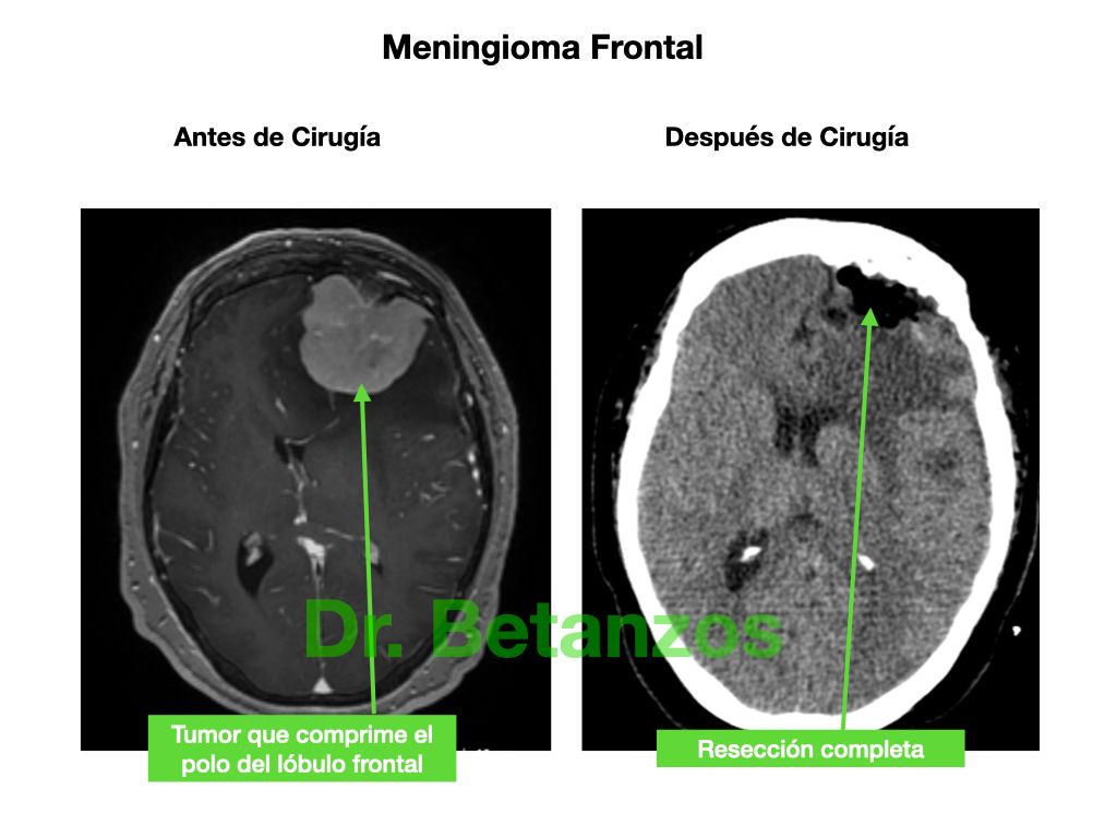 Aleixandre Betanzos Villegas-13