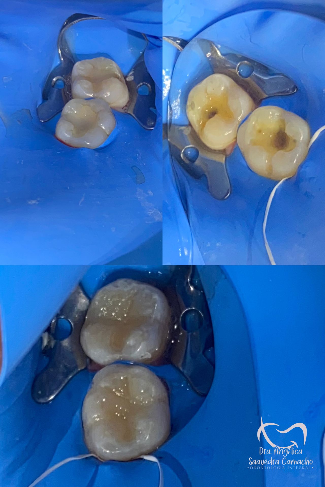 Angélica Saavedra Camacho-3