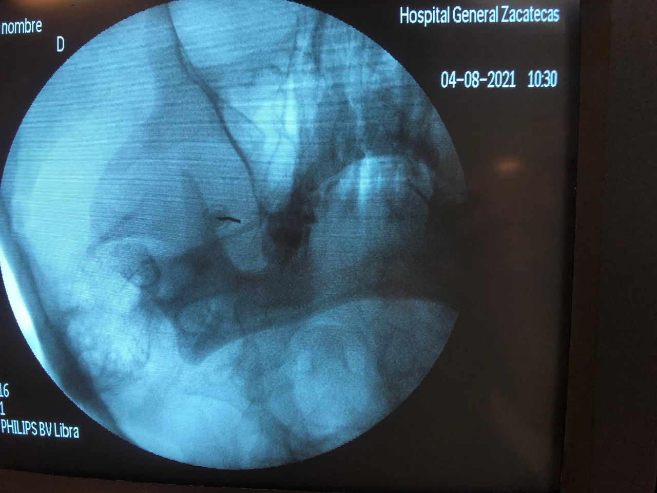 Liber Abdel Arenas Garcia-1