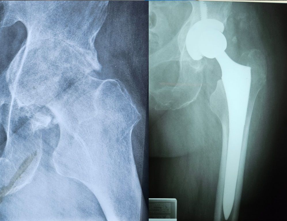 Luis Castañón Robles-0