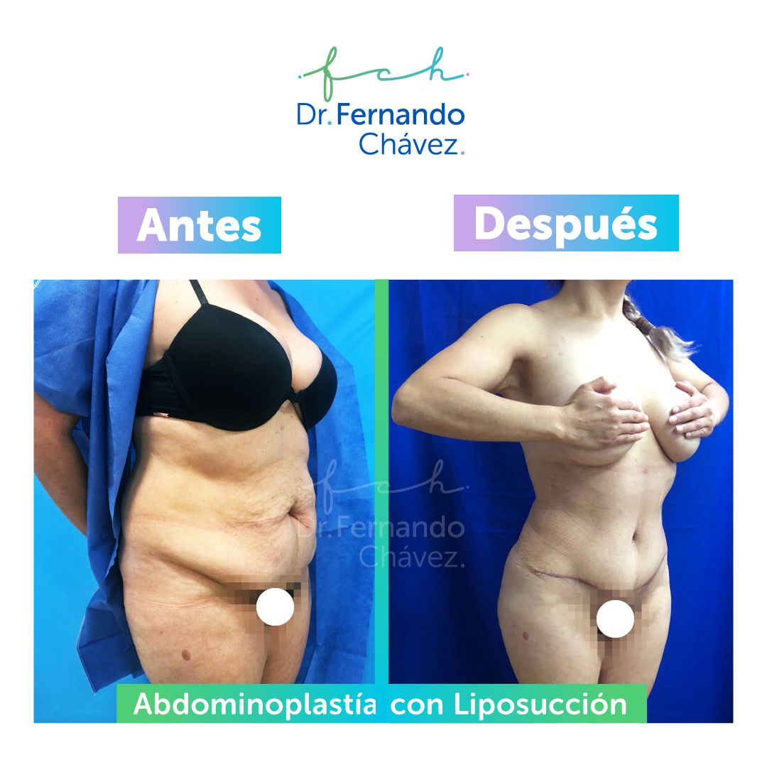 Fernando Chávez Osorio-3