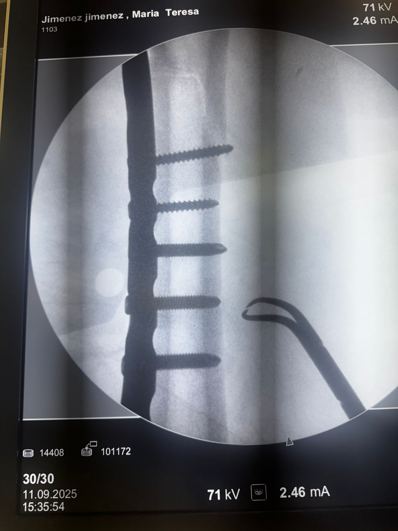 Benjamín Contreras Muñoz-10