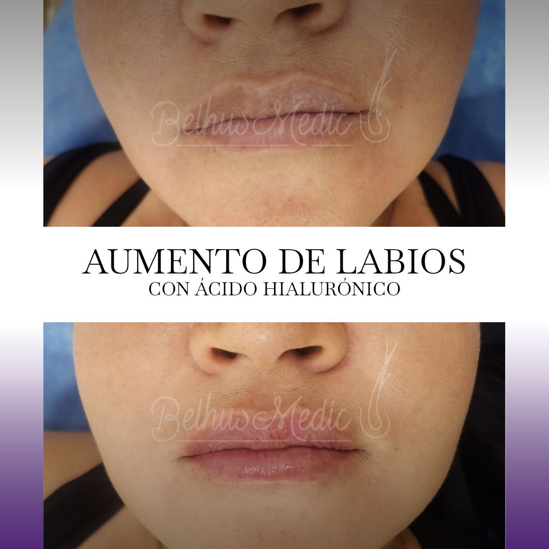 Alejandra Soriano Elorza-96