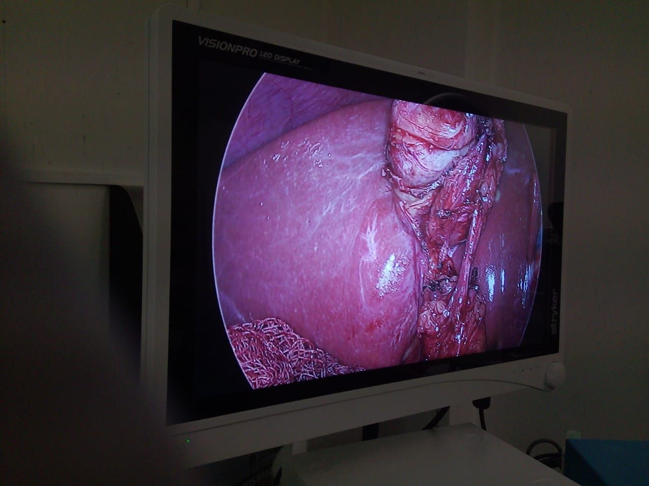 Diego Edwuin Rosales Carmona-16