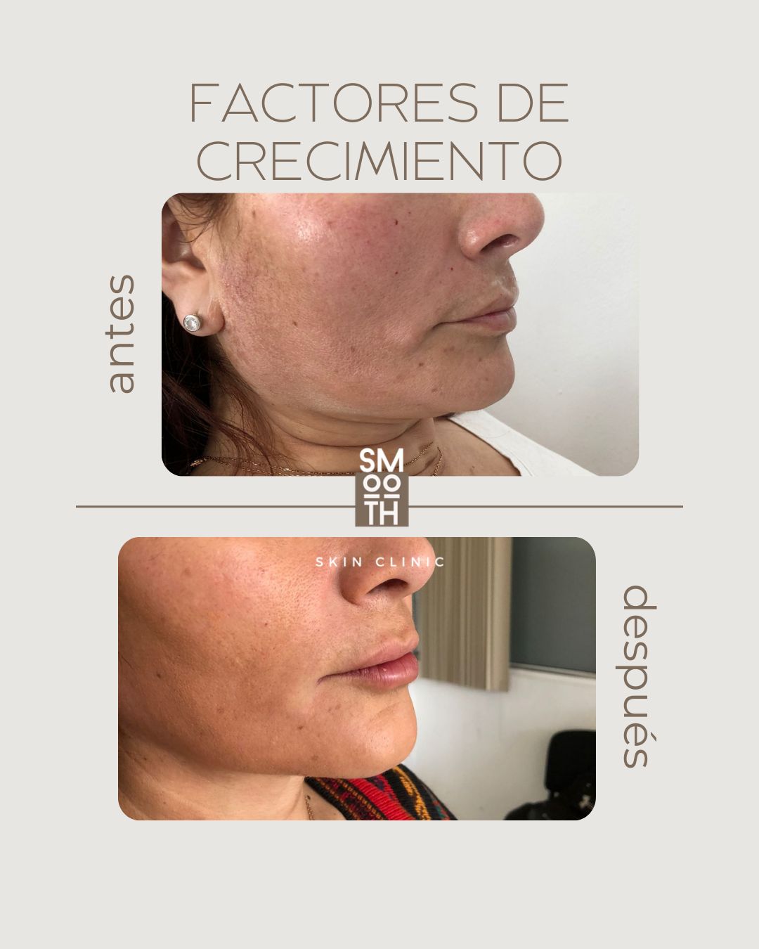 Samantha Martínez-30