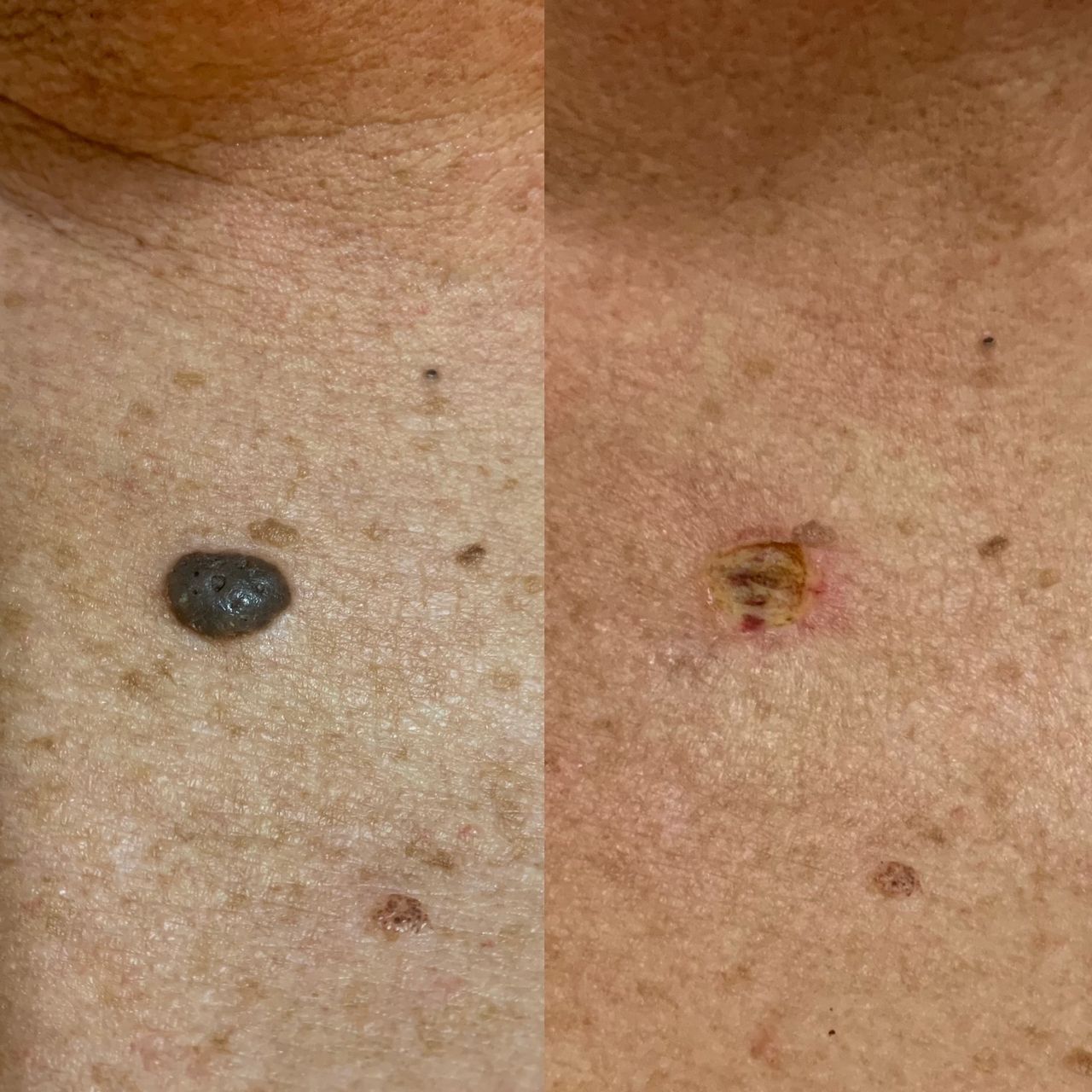 Carlos Rene Guerrero Acero-0