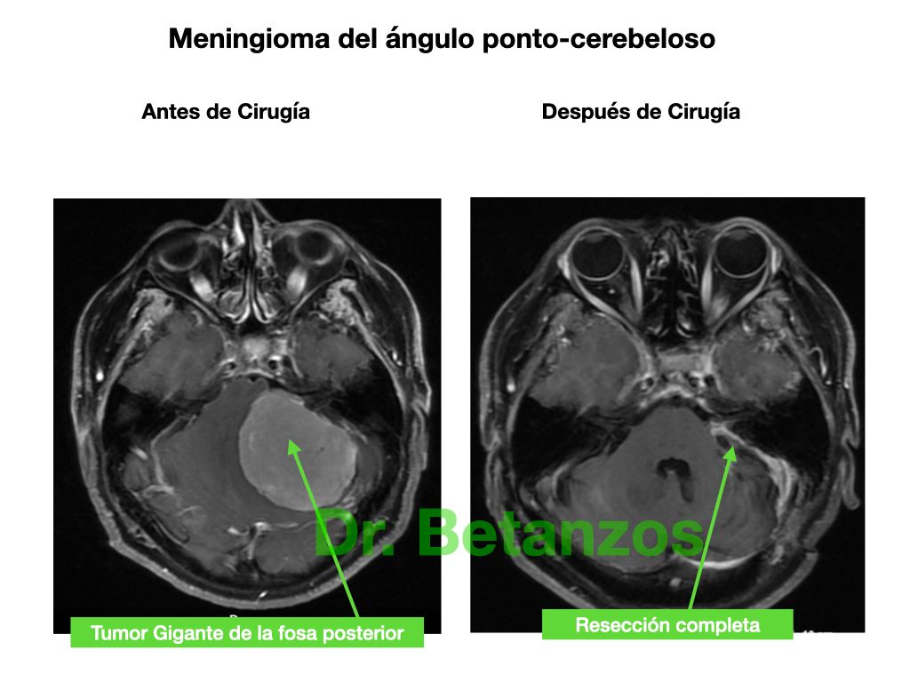 Aleixandre Betanzos Villegas-16