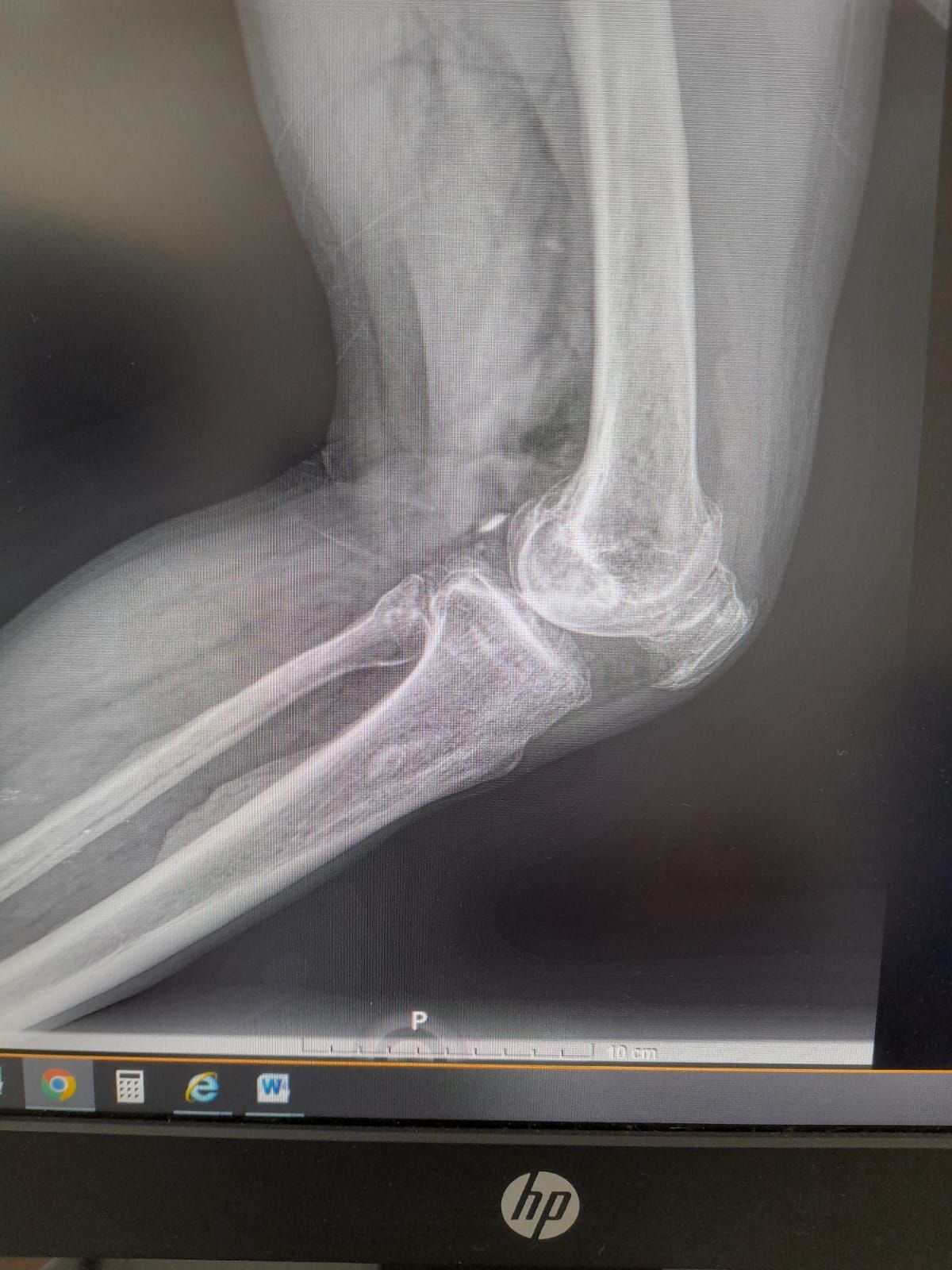 Lizeth Patricia Mena Rivas-32