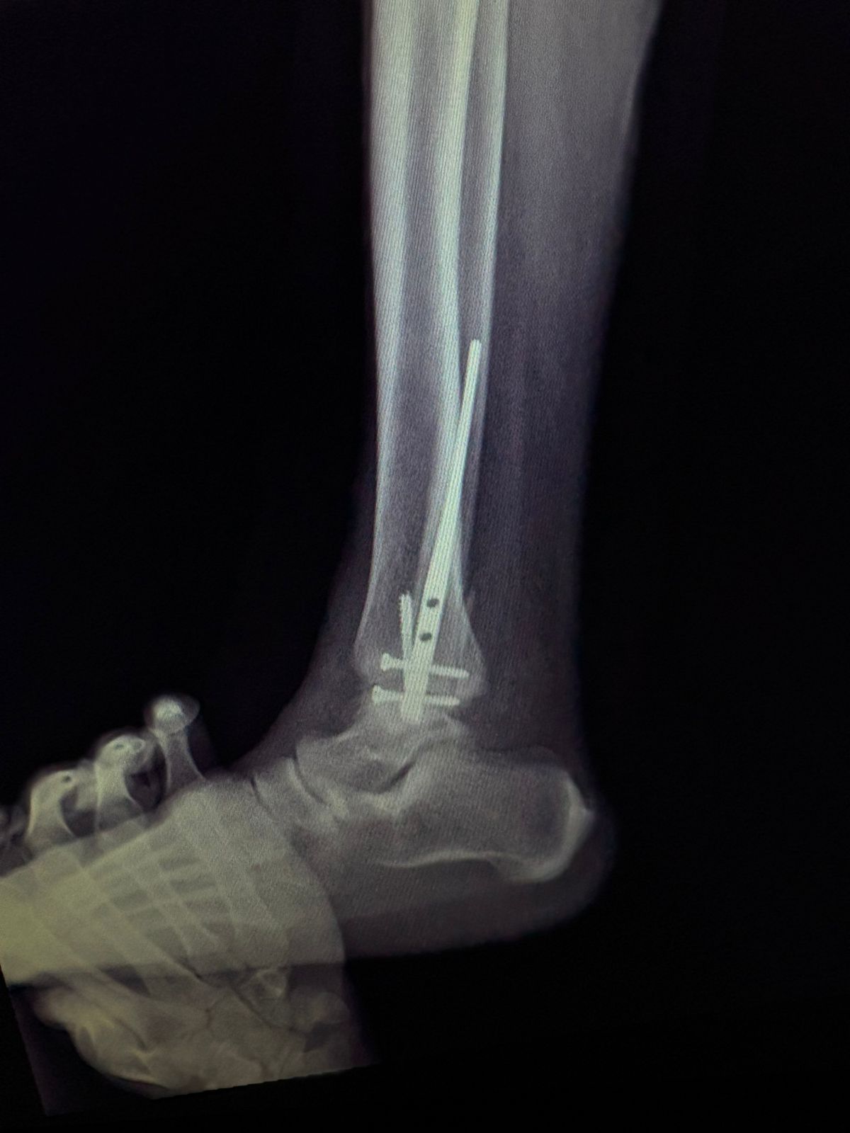 Humberto Antonio Hernández Gómez-7