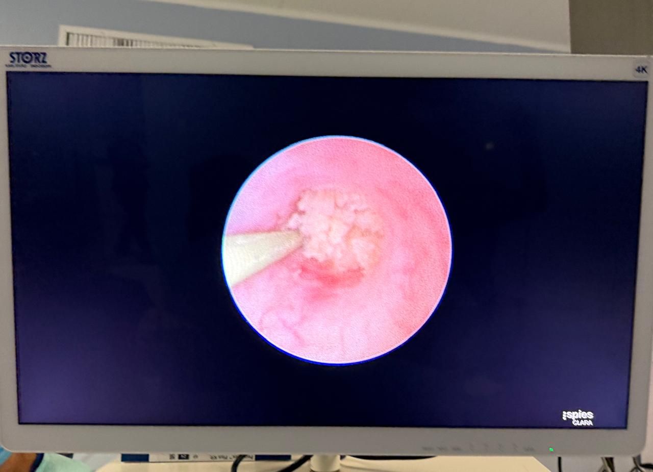 David Ramírez Ramírez-23