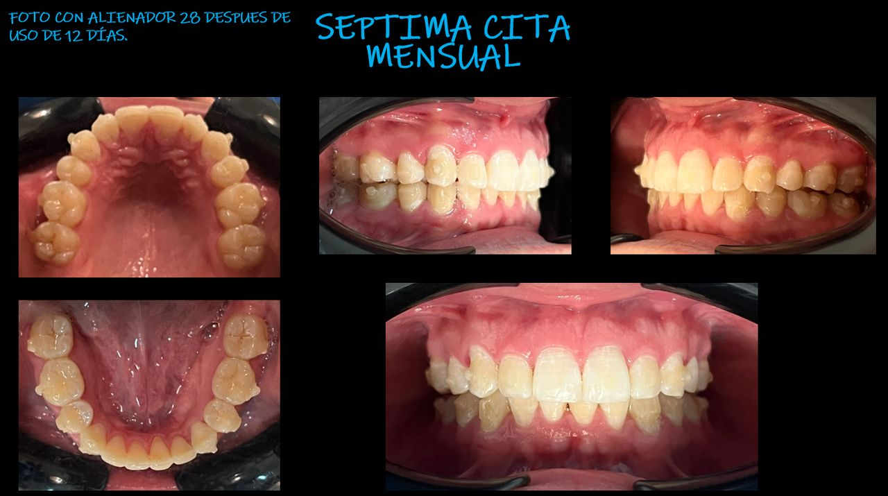 Vicente Emmanuel Silva Rangel-8