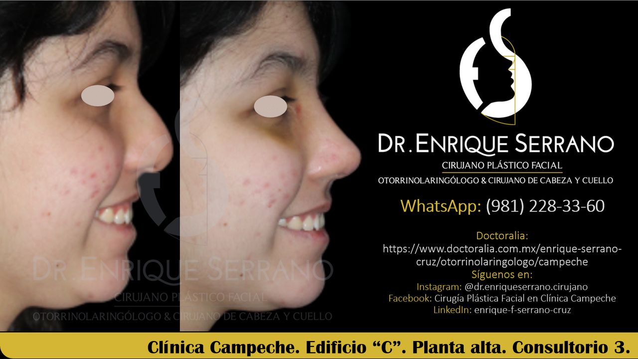 Enrique Serrano Cruz-67