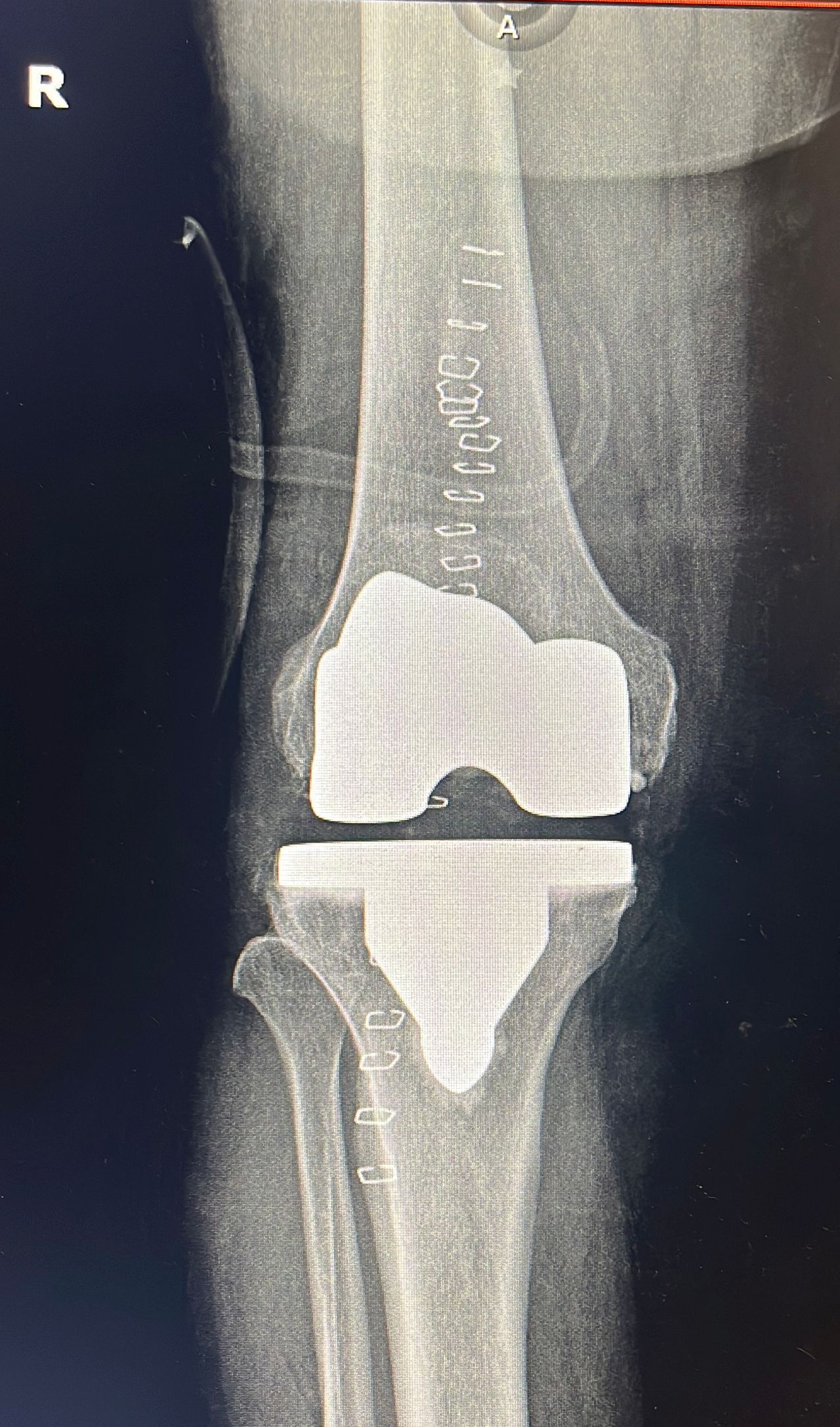 David Bernadac Giacomán-1