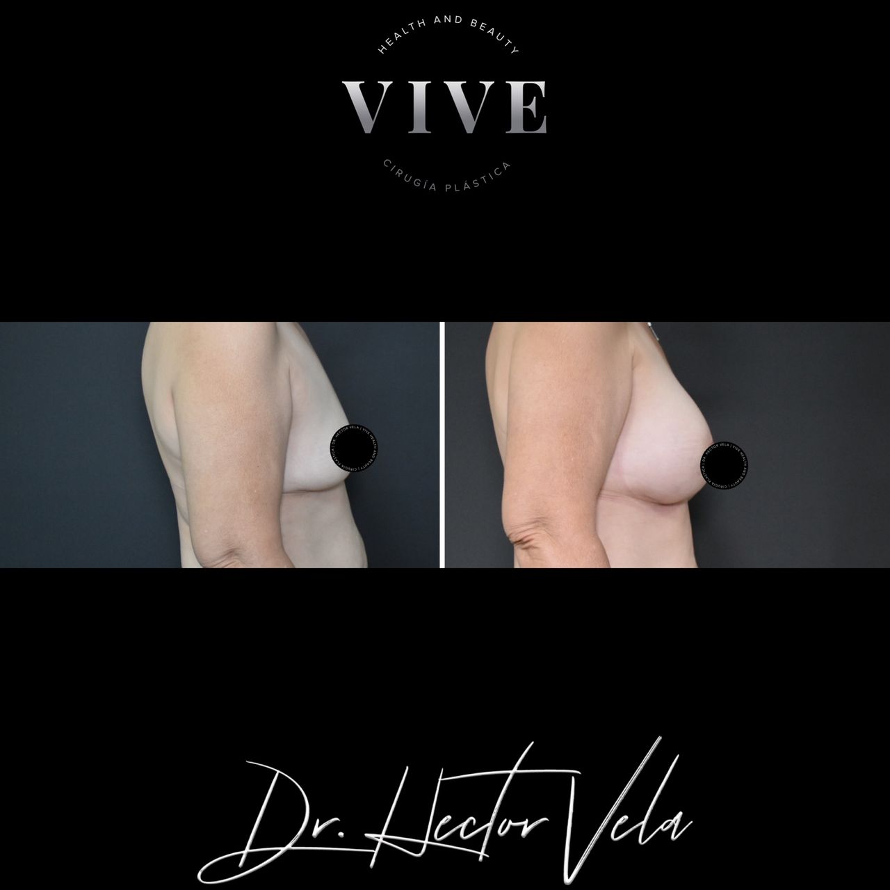 Héctor Eduardo Vela Cardona-117