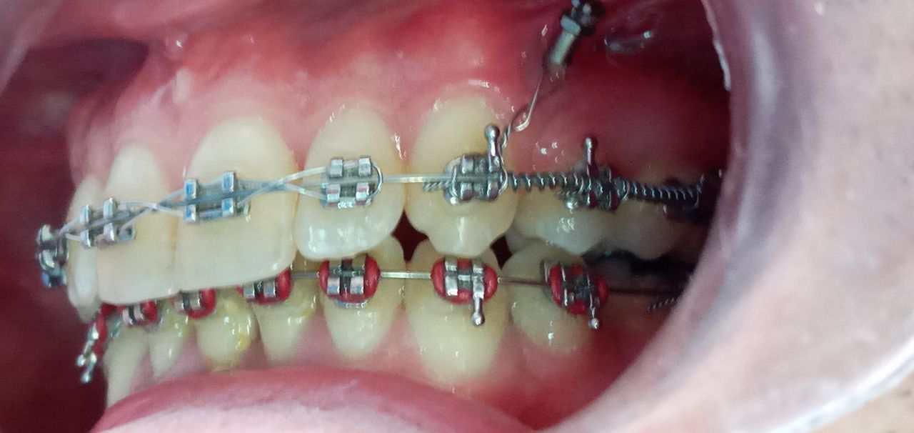 Giovanna Paola Huerta De Santiago-20