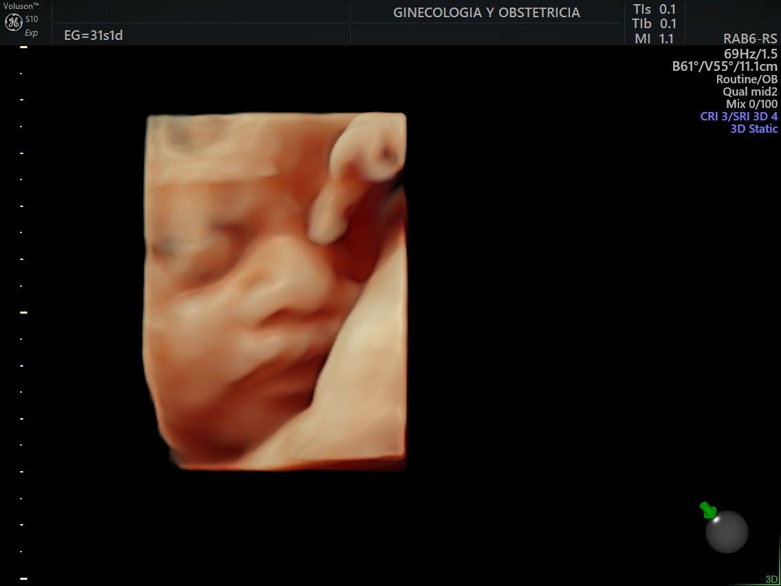 Juan Jose Pacheco Uc-6