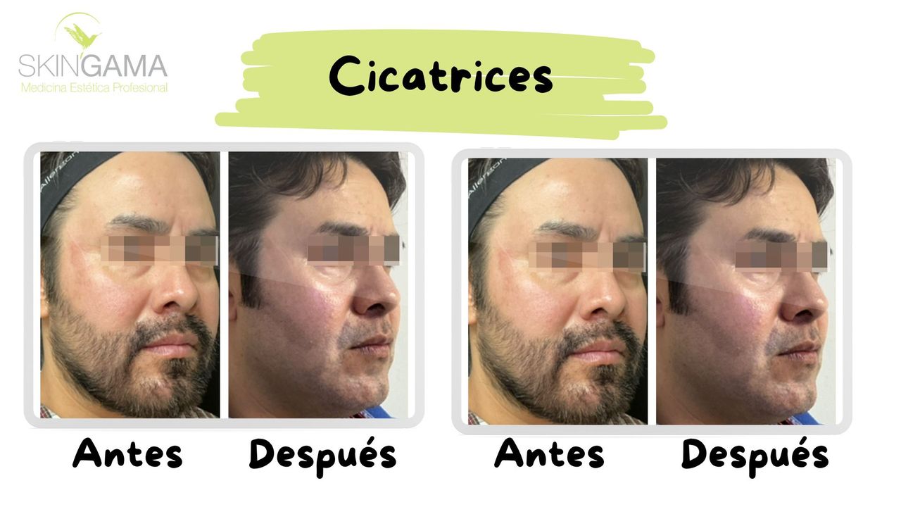 Juan Herrera Hernández-56