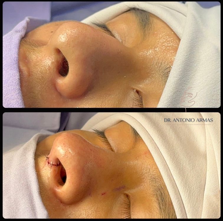 Juan Antonio González Armas-11